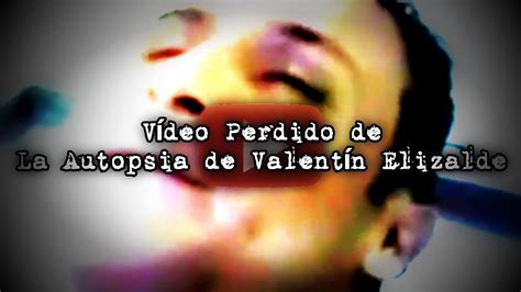 autopsia valentina elizalde|Video de la autopsia de Valentín Elizalde; 17 años después sigue。